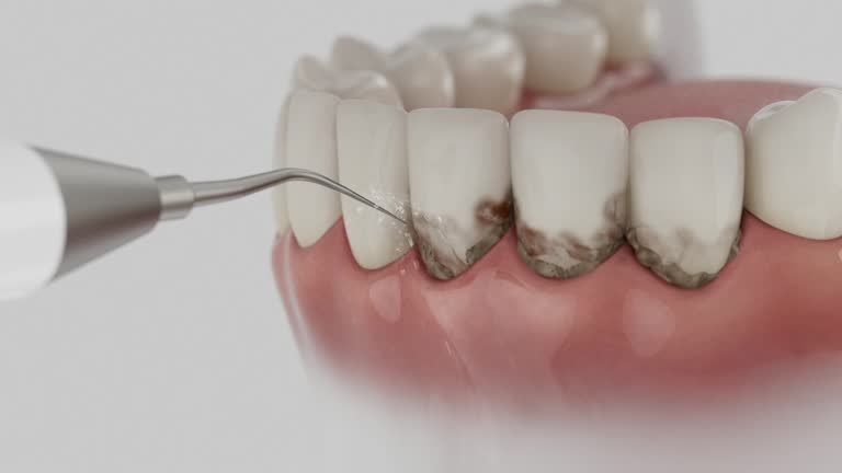 Reliable Dental Implants contractor in Grafton, ND by Smile Center Dentistry